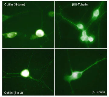 Anti-Cofilin 1 (N-terminus) Antibody - Image 2