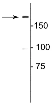 Anti-Collagen 1, alpha 1 propeptide Antibody