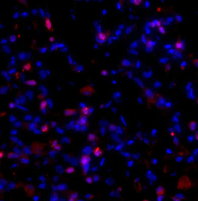 Anti-Collagen 1, alpha 1 propeptide Antibody - Image 2