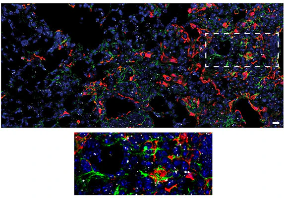 Anti-Collagen 1, alpha 1 propeptide Antibody - Image 3