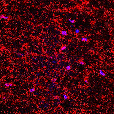 Anti-Collagen 1, alpha 1 telopeptide Antibody - Image 2