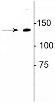Anti-Collagen 1, alpha 1 telopeptide Antibody - Image 3