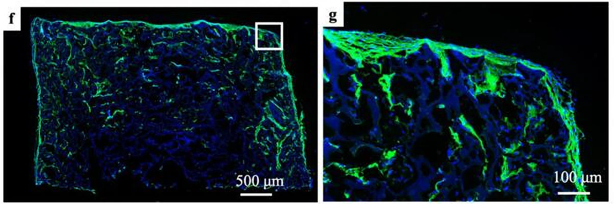 Anti-Collagen 1, alpha 1 telopeptide Antibody - Image 4