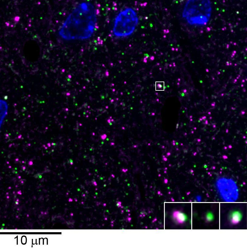 Anti-Collybistin Antibody