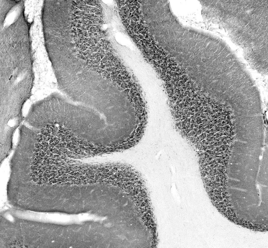 Anti-Collybistin Antibody