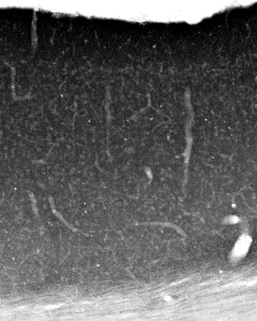 Anti-Collybistin Antibody - Image 2