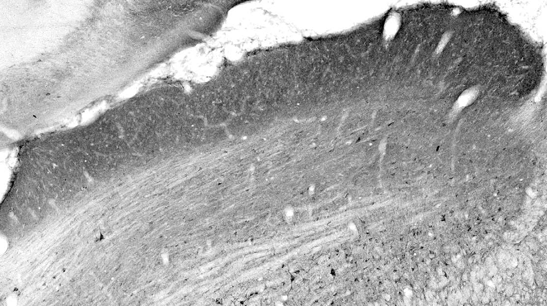 Anti-Collybistin Antibody - Image 3