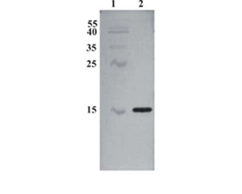 Anti-Conserved dopamine neurotrophic factor (CDNF) Antibody