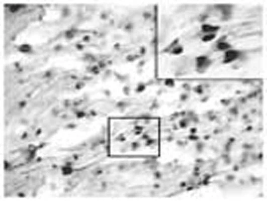 Anti-Contactin-6 Antibody