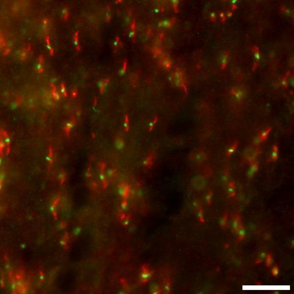 Anti-Contactin/F3 Antibody
