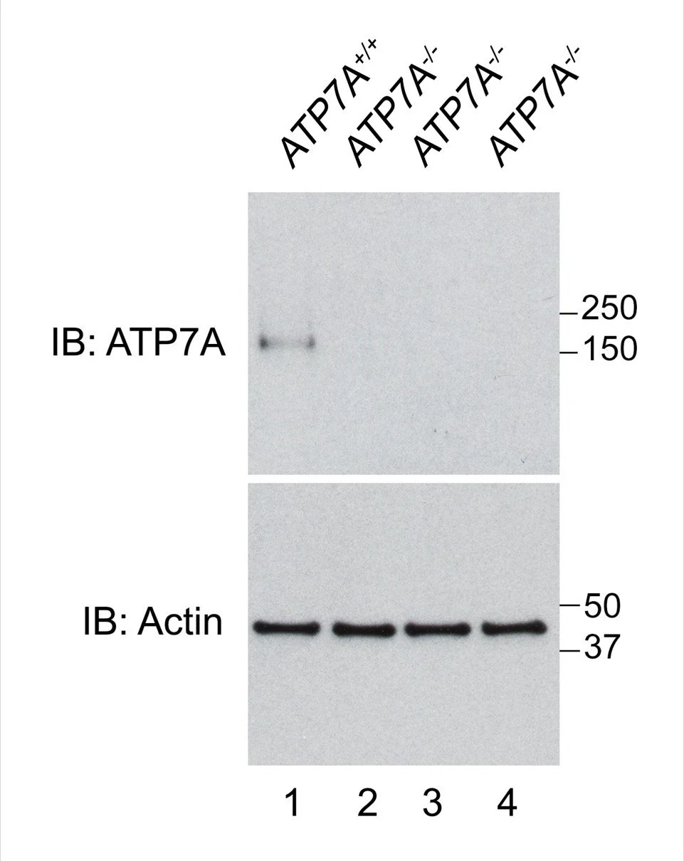 Anti-Copper ATPase 1 (Menke's Disease Protein) Antibody - Image 2