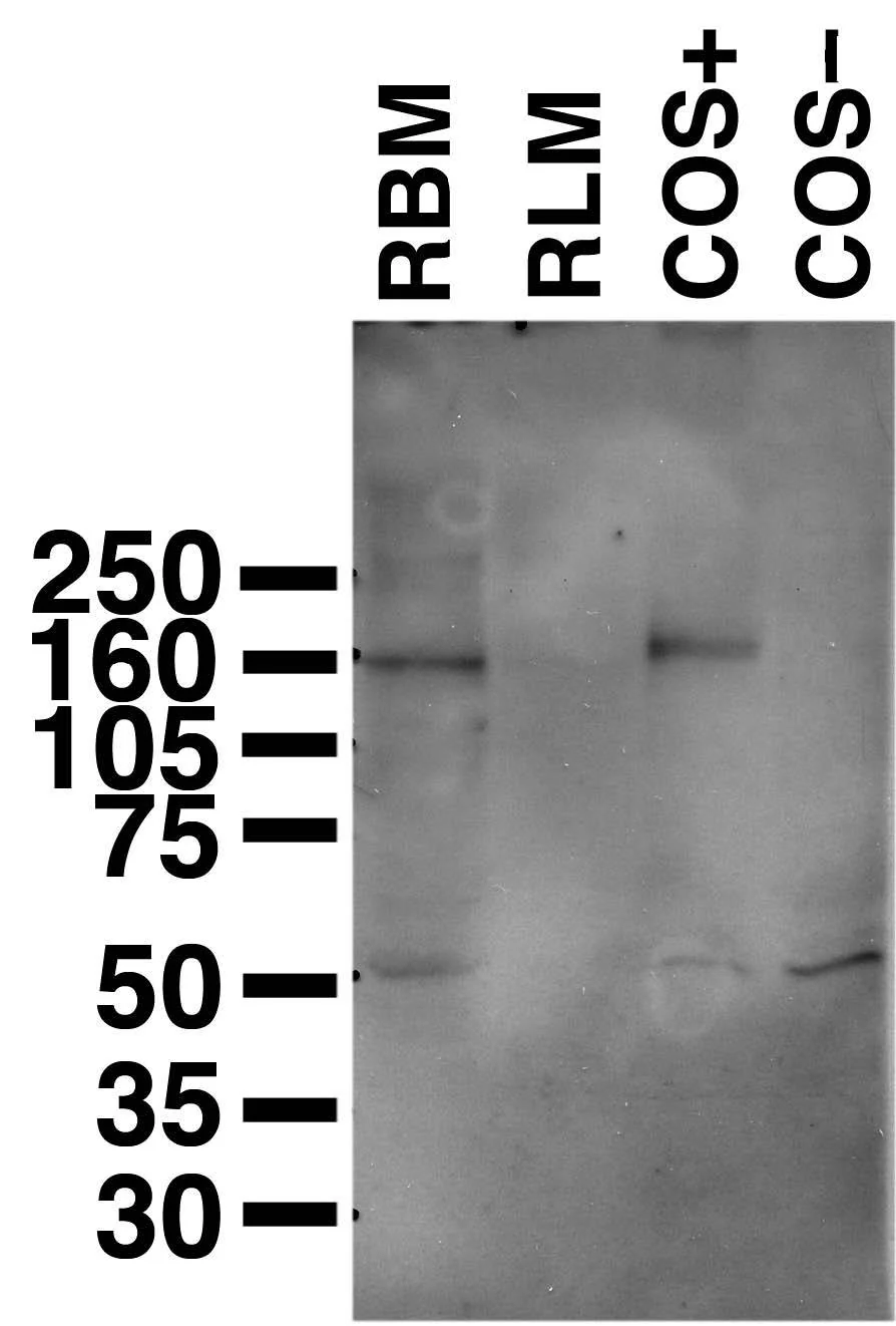 Anti-Copper ATPase 2 (Wilson's Disease Protein) Antibody