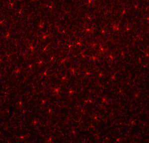 Anti-Coronin 1A Antibody - Image 3