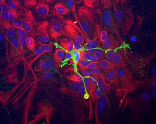 Anti-Coronin-1A Antibody