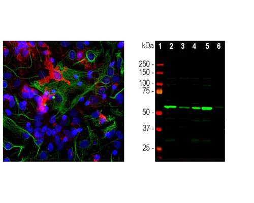Anti-Coronin-1A Antibody - Image 2
