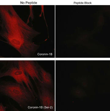 Anti-Coronin-1B (C-terminus) Antibody - Image 2