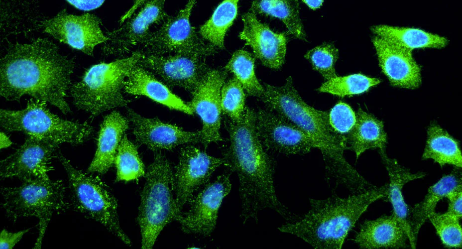 Anti-Cortactin Recombinant Chicken Chimeric mAb