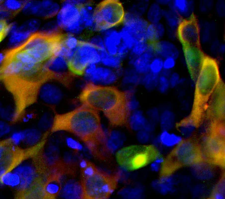Anti-CRISPR Cas9 Antibody