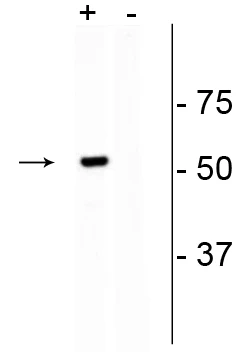 Anti-CRISPR Cas9 Antibody - Image 2