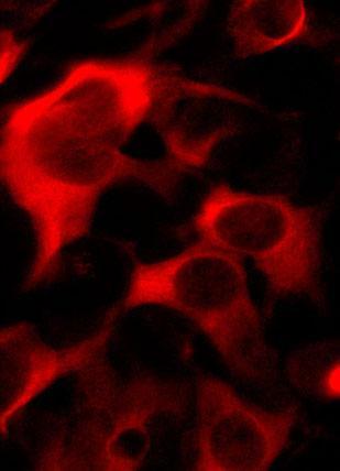 Anti-CRISPR Cas9 Antibody - Image 3