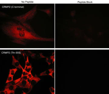 Anti-CRMP2 (C-terminal region) Antibody - Image 2