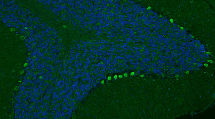 Anti-CSPG4/NG2 Recombinant Chicken Chimeric mAb - Image 3
