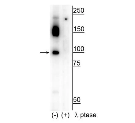 Anti-CtIP (Ser326) Antibody