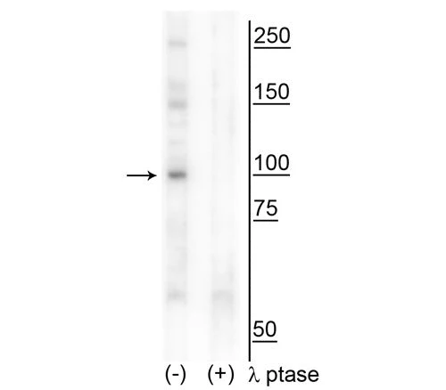 Anti-CtIP (Thr847) Antibody