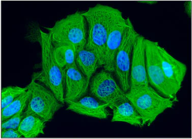 Anti-Cytokeratin 18 (CK18) Antibody