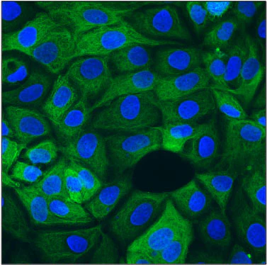 Anti-Cytokeratin 19 (CK19) Antibody