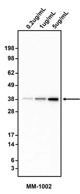 Anti-Cytokeratin 19 (CK19) Antibody - Image 2