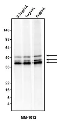 Anti-Cytokeratin Cocktail Antibody - Image 2