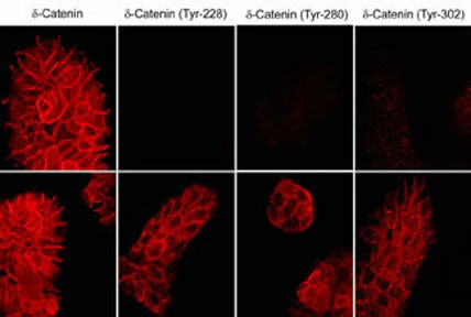 Anti-δ1-Catenin (Tyr-228), Phosphospecific Antibody - Image 2