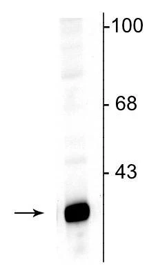 Anti-DARPP-32 Antibody - Image 2