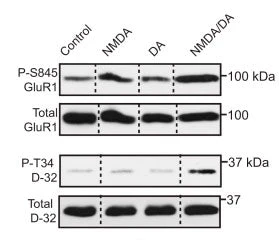 Anti-DARPP-32 (Thr34) Antibody - Image 2