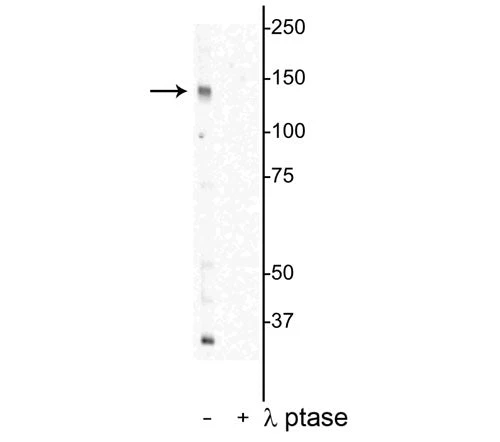 Anti-DENND3 (Thr450) Antibody