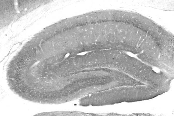 Anti-DLX1 Antibody