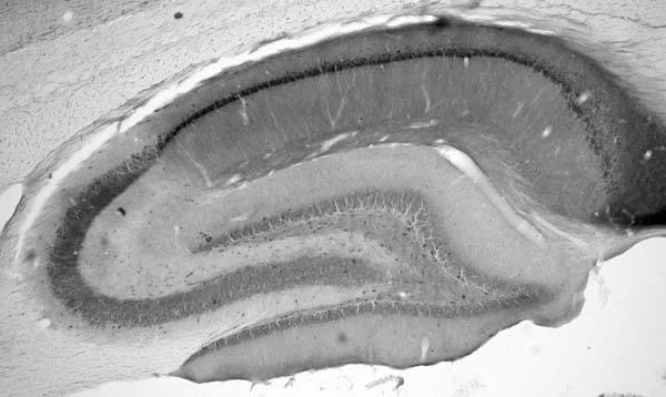 Anti-Doc2B Antibody