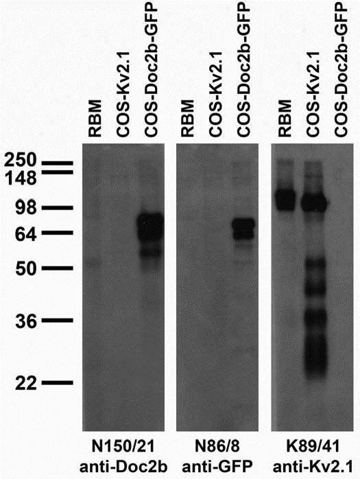 Anti-Doc2B Antibody - Image 2