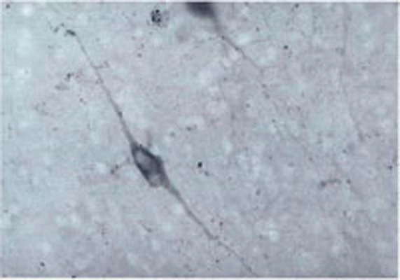 Anti-Dopamine beta-hydroxylase (DBH) Antibody