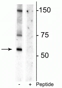 Anti-Dopamine Transporter (Thr53) Antibody