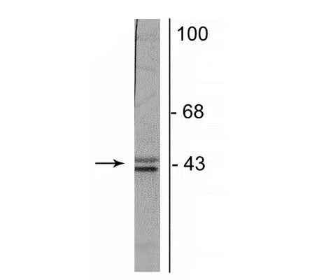Anti-Doublecortin Antibody - Image 2