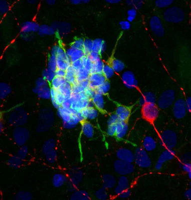 Anti-Doublecortin Antibody - Image 3
