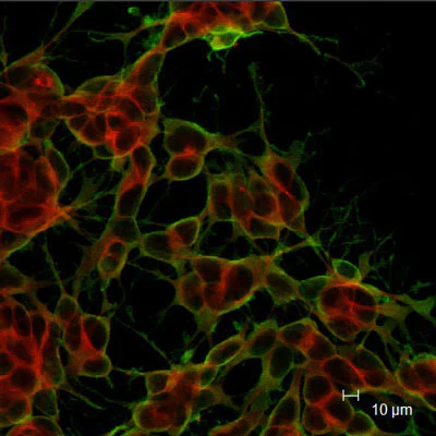 Anti-Doublecortin Antibody