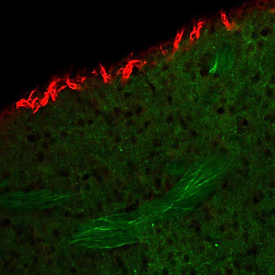 Anti-Doublecortin Antibody - Image 5