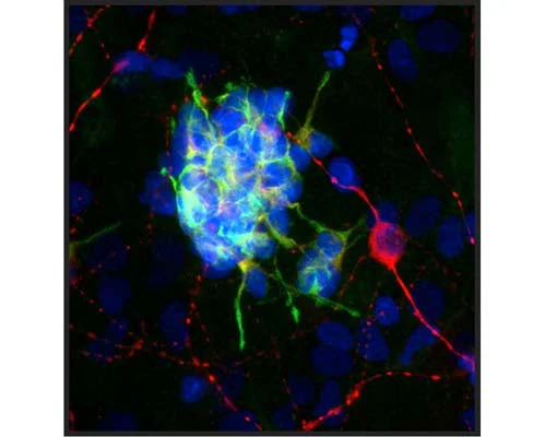 Anti-Doublecortin (DCX) Antibody - Image 2