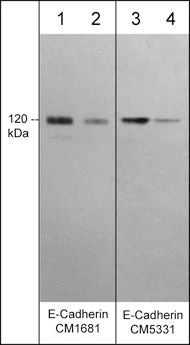 Anti-E-Cadherin (C-terminal fragment) Antibody