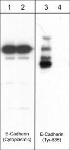 Anti-E-Cadherin (Cytoplasmic) Antibody