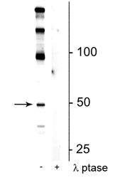Anti-eEF1A2 (Ser358) Antibody