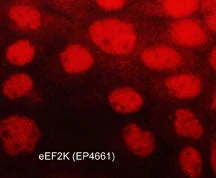 Anti-eEF2K (C-terminus) Antibody - Image 2